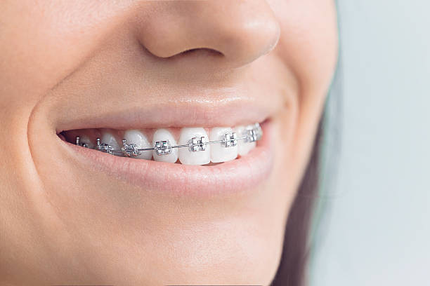 Best Dental Fillings (Composite and Amalgam)  in Carolina Forest, SC